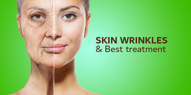 Skin wrinkles & Best treatment